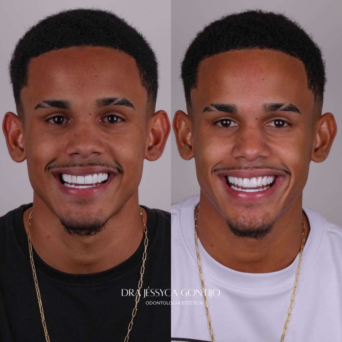 Antes e depois, caso 8