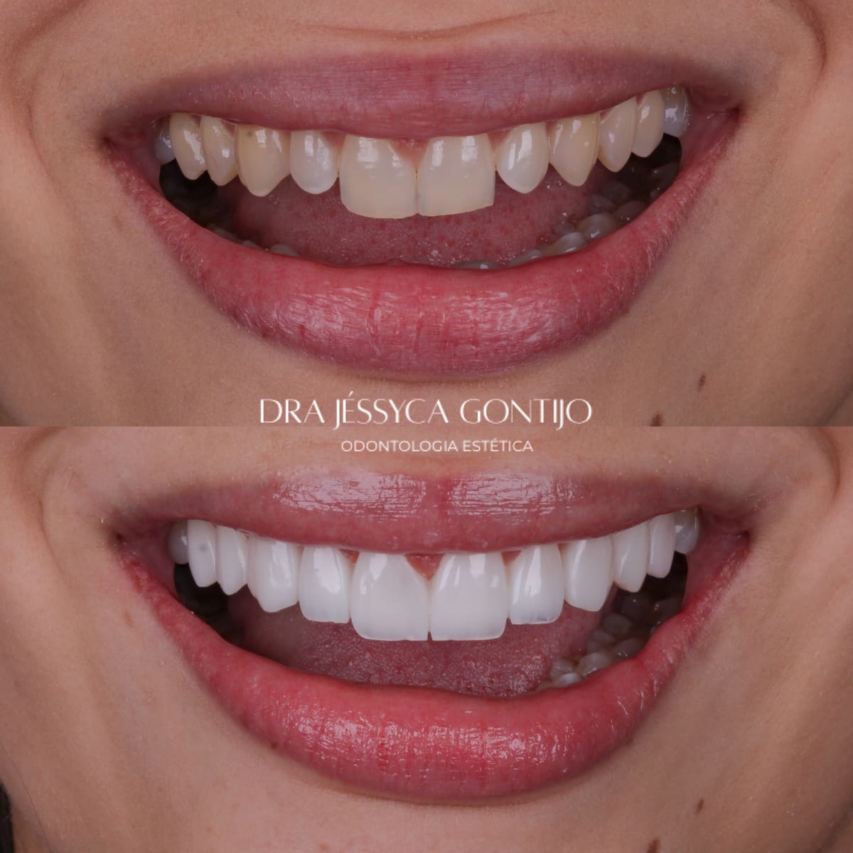 Antes e depois, caso 9
